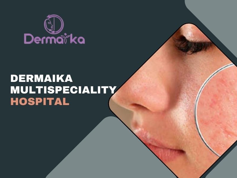 Dermaika Multispeciality Hospital